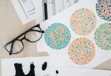 hyper node 662900794 vision